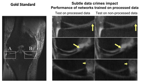 scan comparisons