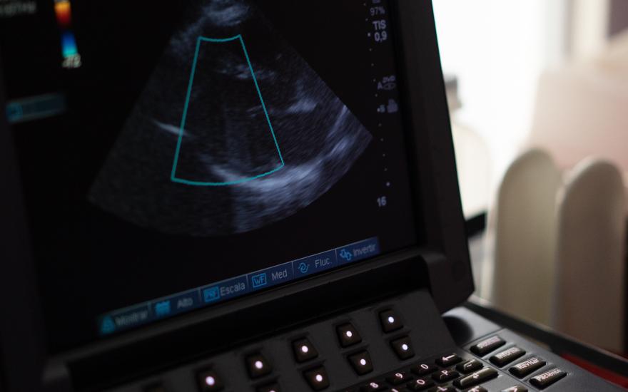 Echocardiogram Image